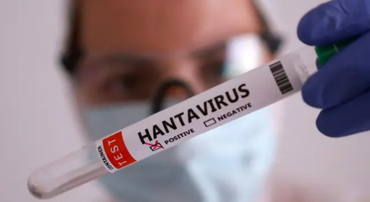 Hantavirus