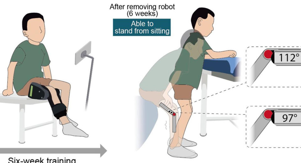 Robot portátil devuelve esperanza a niños con atrofia muscular