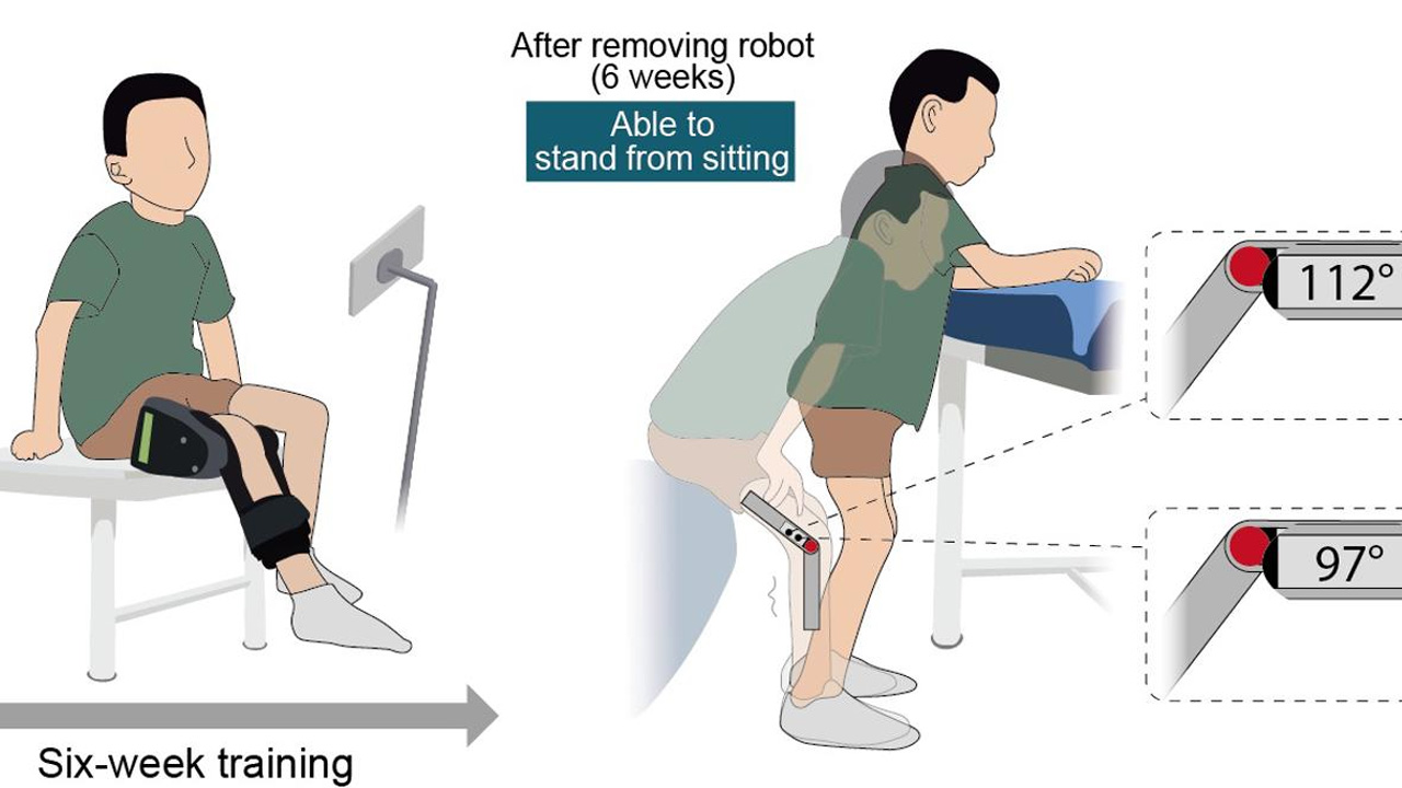 Robot portátil devuelve esperanza a niños con atrofia muscular