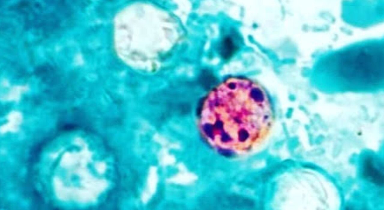 Brote de ciclosporiasis se extiende en EE.UU.; aumentan los casos del parásito asociado a alimentos contaminados