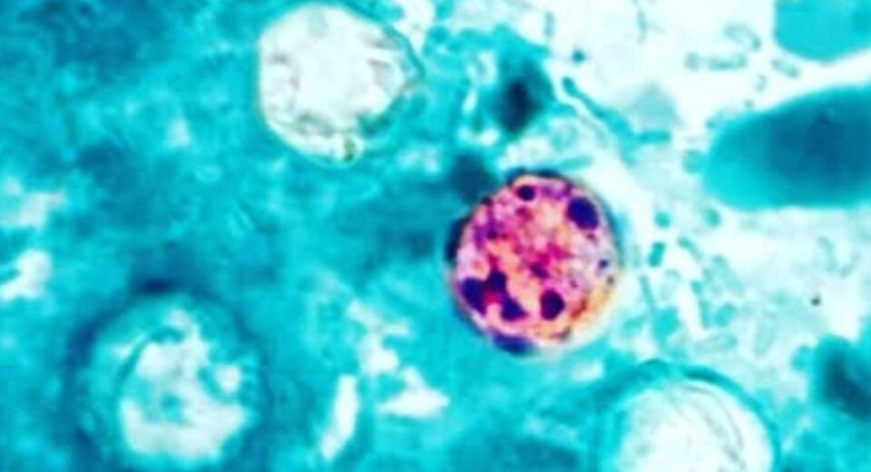 Brote de ciclosporiasis se extiende en EE.UU.; aumentan los casos del parásito asociado a alimentos contaminados