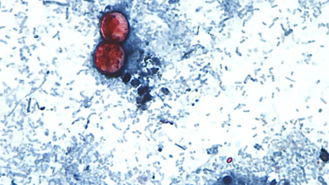ciclosporiasis